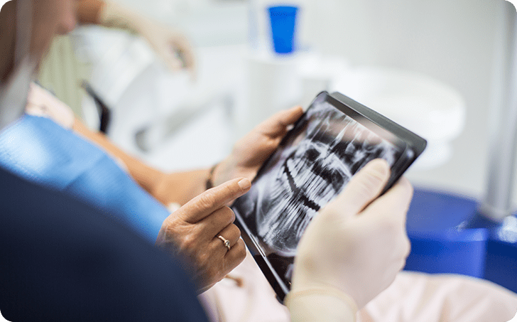 Medical professional holding teeth xray film